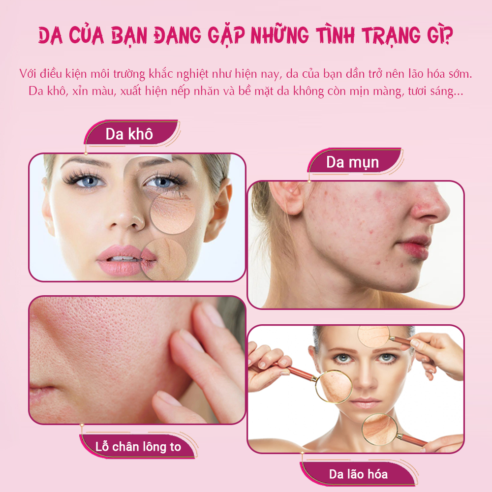 Tinh chất hoa hồng KISS ON cấp ẩm, thu nhỏ lỗ chân lông, da sáng đều màu, phục hồi hư tổn Kisson 30ml JN-KI-TC01