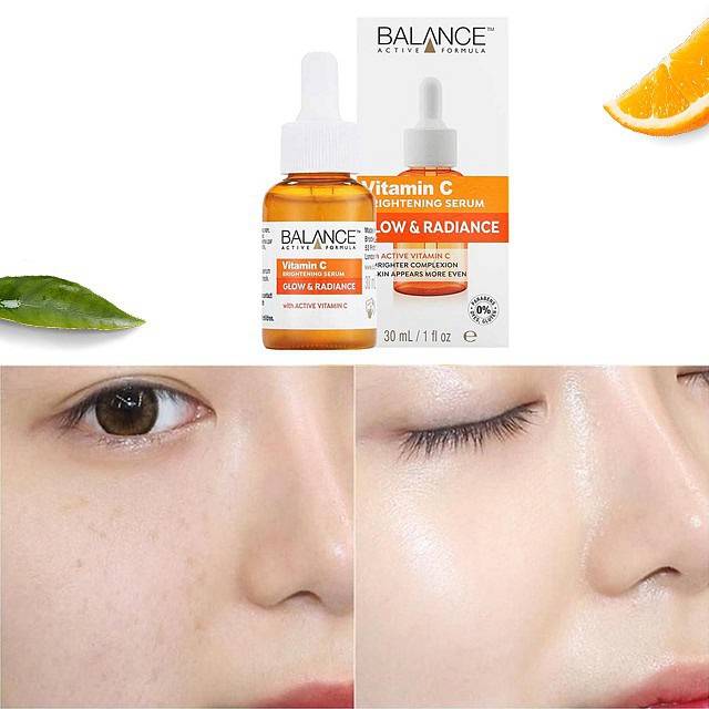 Serum Balance Vitamin C Giúp Trắng Da, Mờ Thâm Active Formula Brightening 30ml - Tặng Kèm Cột Tóc Nơ BERAV Handmade Annie Ribbon Giao Màu Ngẫu Nhiên