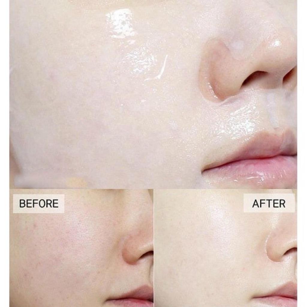 Combo 5 Mặt Nạ 3D Foodaholic Natural Essence Mask Olive Dưỡng Da 23g/Miếng