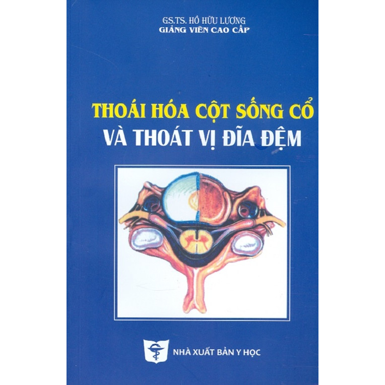 Thoái Hóa Cột Sống Cổ Và Thoát Vị Đĩa Đệm