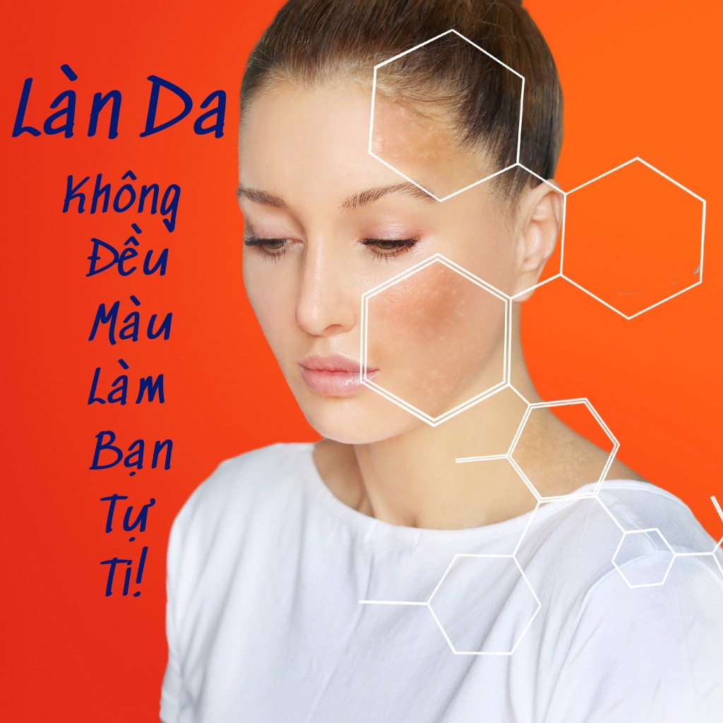 Kem Dưỡng Thể Redwin Vitamin E & C Body Lotion Mềm Min Sáng Da 400ml