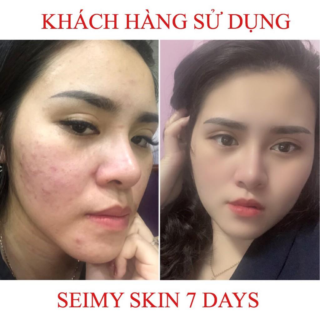 Serum ngừa mụn, giảm mụn thâm rỗ Seimy - Skin 7 Days - Công dụng 5 trong 1 hiệu quả sau 7 ngày