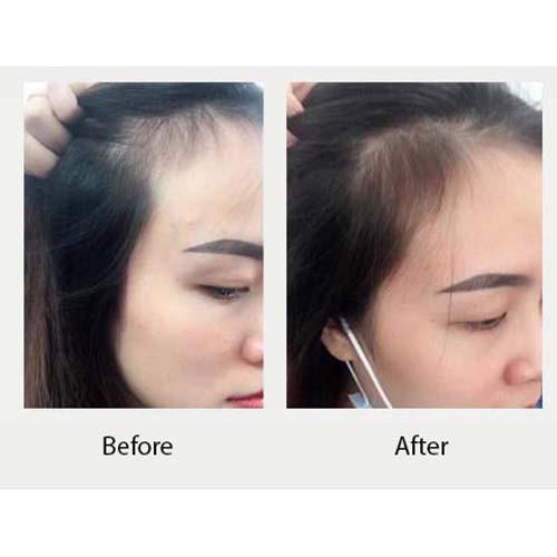 Huyết thanh kích mọc và làm dày tóc Weilaiya Ginger Hair Root Nourishing Essence