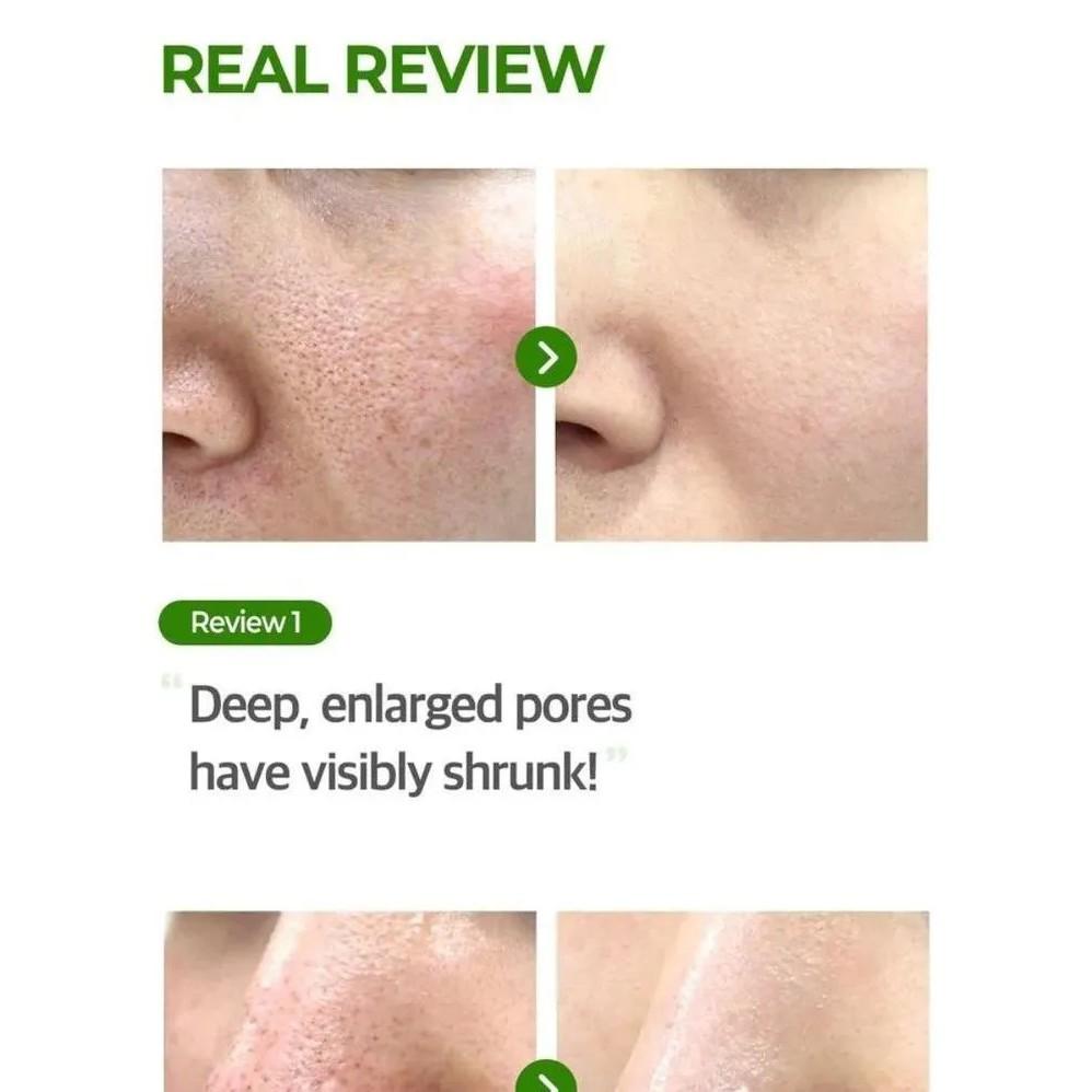 Serum Điều Tiết Bã Nhờn, Se Khít Lỗ Chân Lông,  Mụn Some By Mi Super Matcha Pore Tightening 50ml