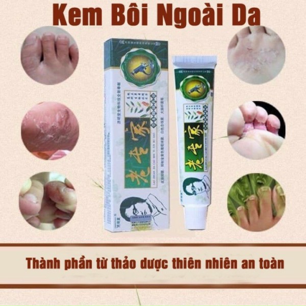 Hàng có sẵn- kem bôi ngứa , Kem Bôi Ngoài Da Chống Nứt Nẻ Bong Tróc Khô Da Cực Hiệu Quả(Hộp Xanh),