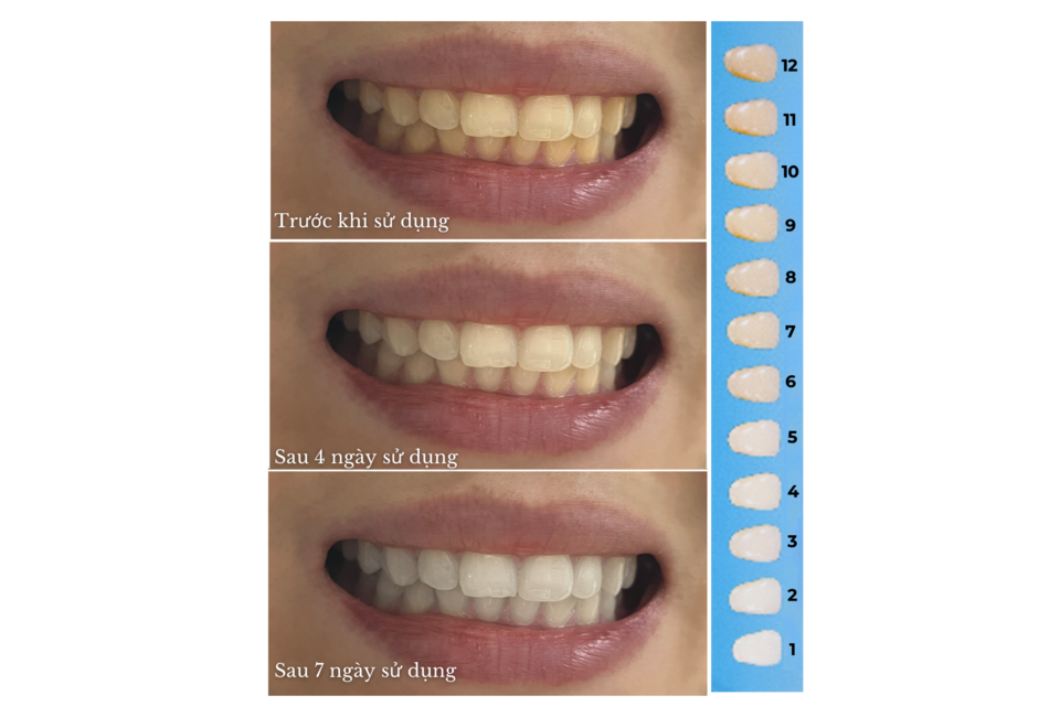 Set 7 Miếng Dán Trắng Răng Halio Teeth Whitening Strip Giảm Ê Buốt - Liệu Trình 7 Ngày