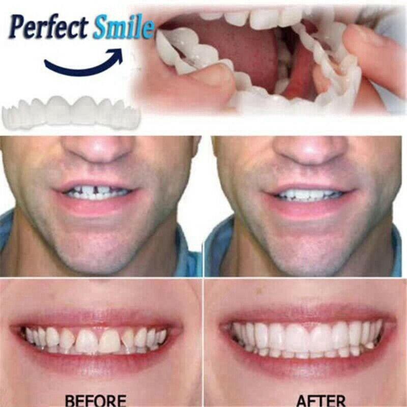 Set 2 hàm răng giả bằng silicon Tự Nhiên Tiện Dụng che khoảng trống răng thưa