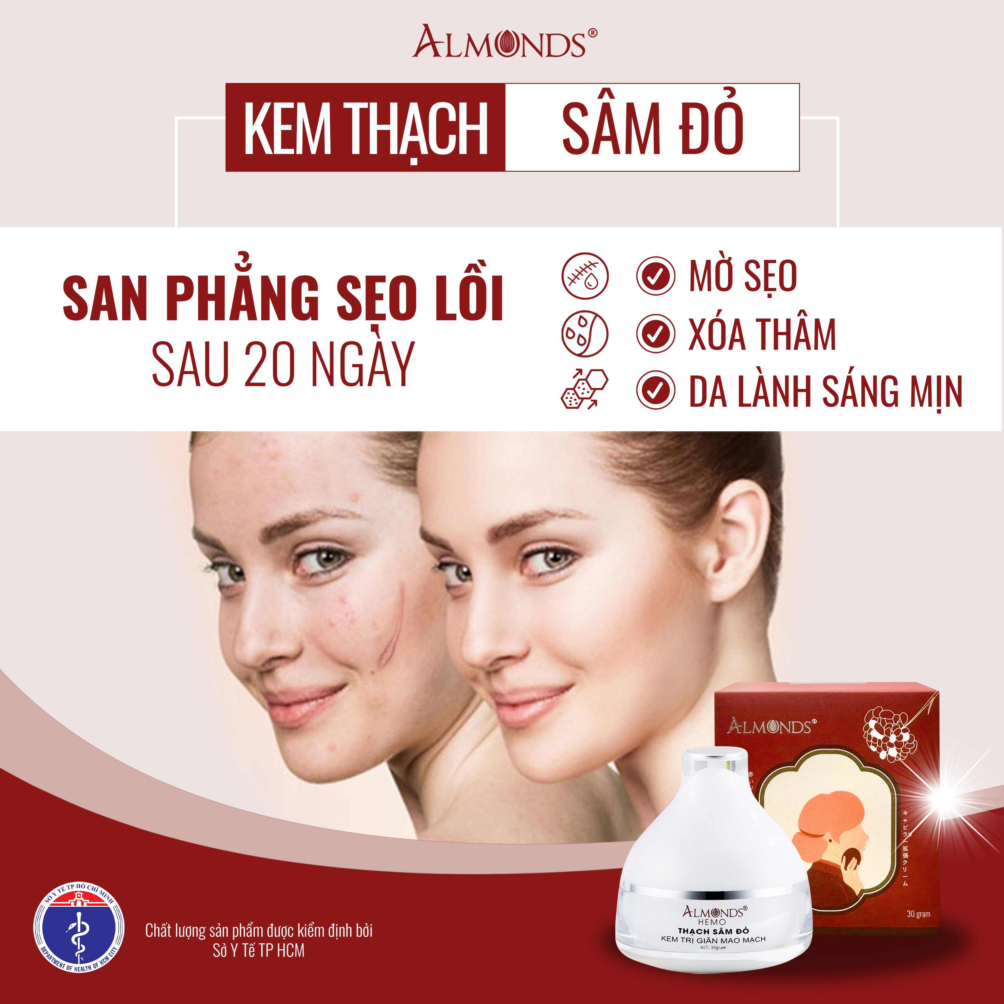 Kem trị giãn mao mạch thạch sâm đỏ- HEMO ALMONDS 30g