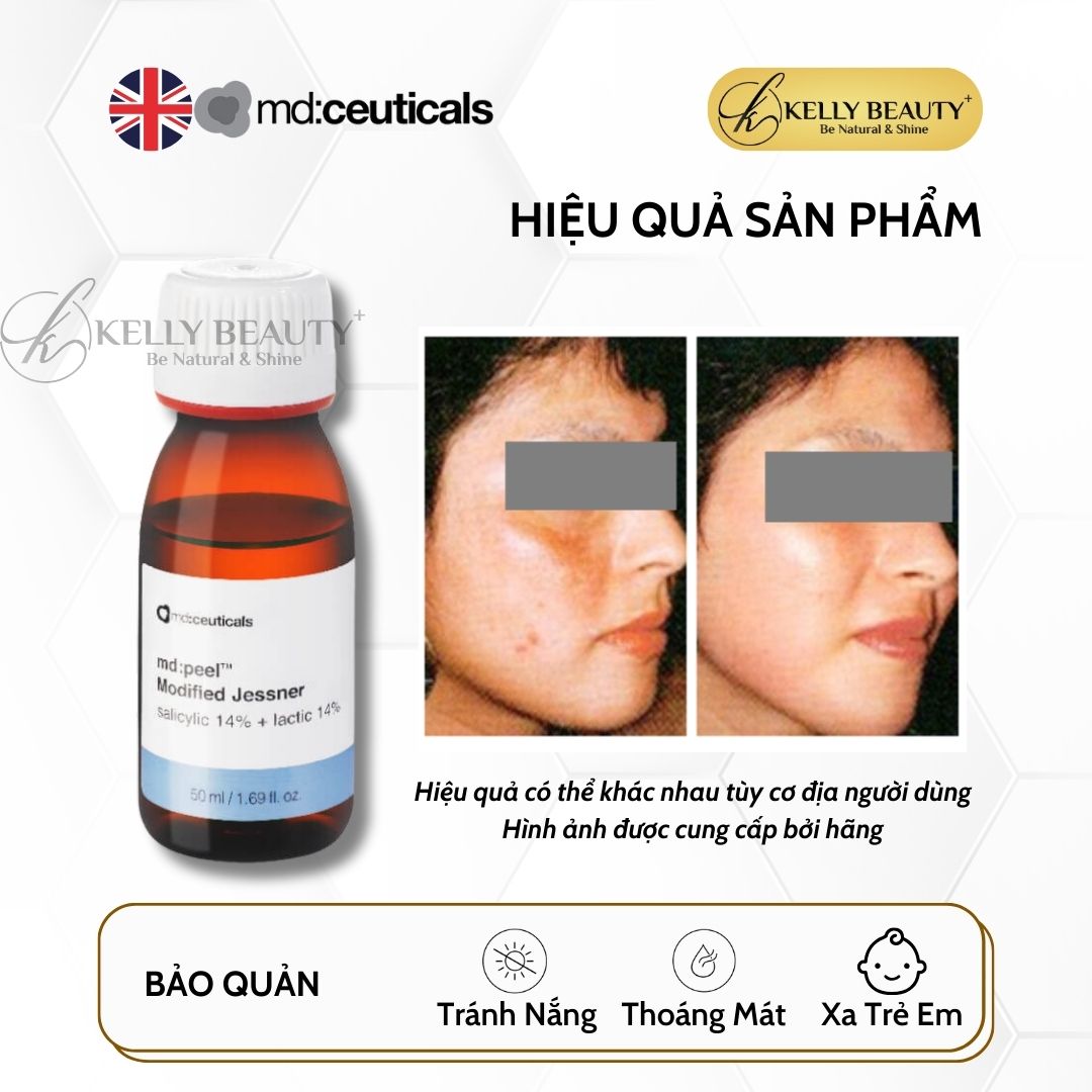 Peel Căng Bóng Sáng Mịn Da MD:PEEL Modified Jessner - MD:Ceuticals | Kelly Beauty