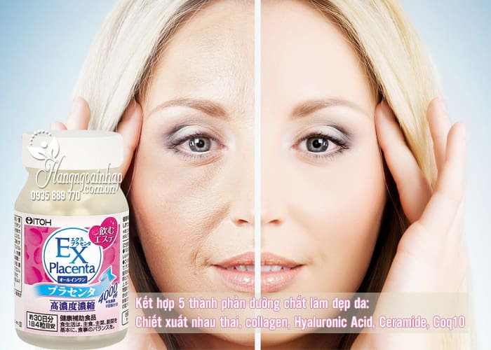 Thực phẩm bảo vệ sức khỏe EX PLACENTA - Cải thiện làn da 120 viên Số 1 Nhật Bản