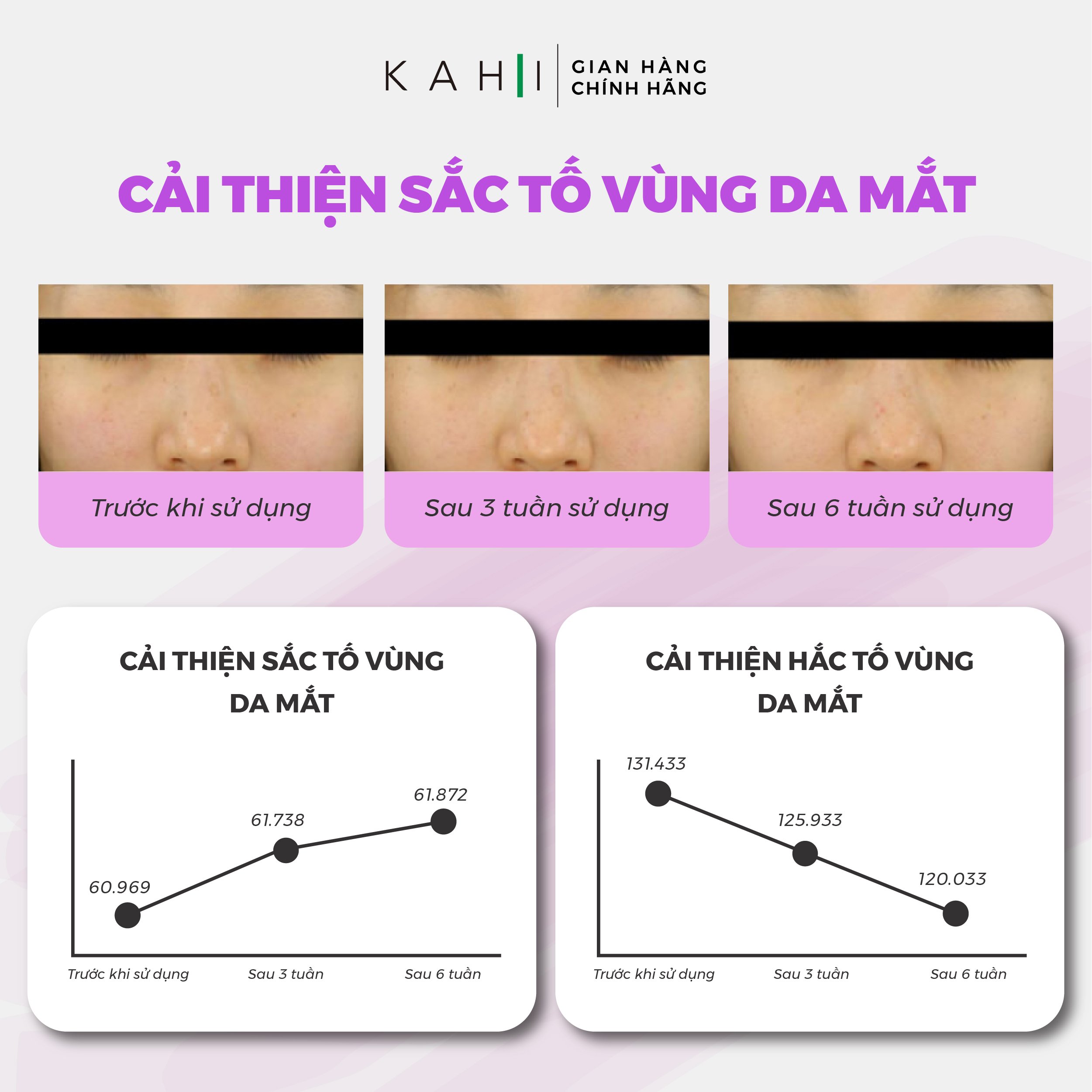 Sáp Dưỡng Ẩm Kahi Eye Balm - Cải Thiện Quầng Thâm Mắt 9g