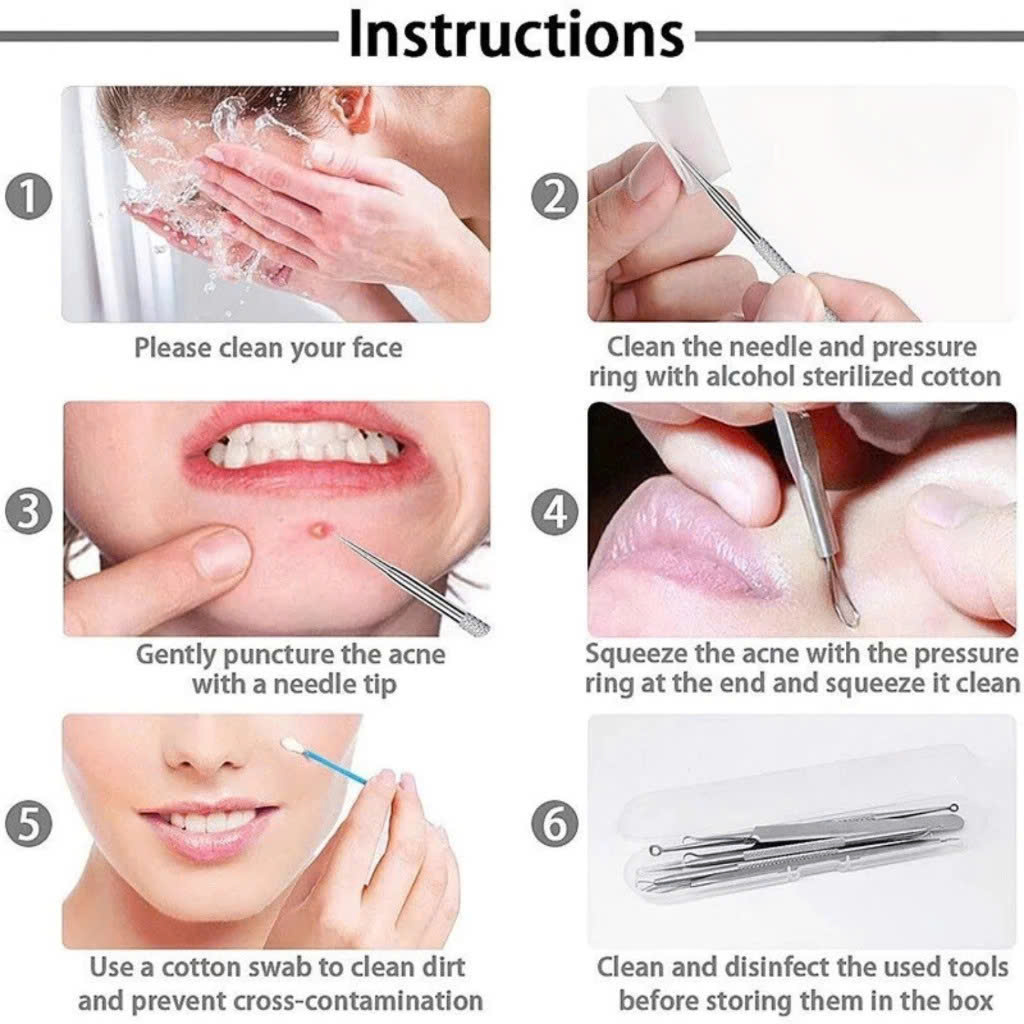 BỘ DỤNG CỤ NẶN MỤN 5 CÂY CÓ HỘP ĐỰNG - Hàng chính hãng