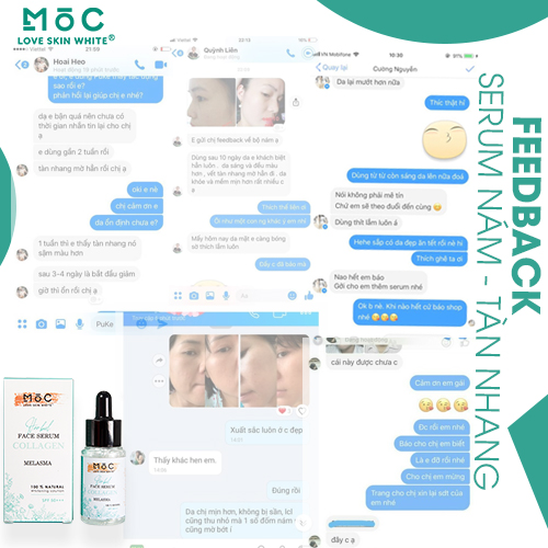 SERUM NGỪA NÁM - TÀN NHANG 25ML - MOC