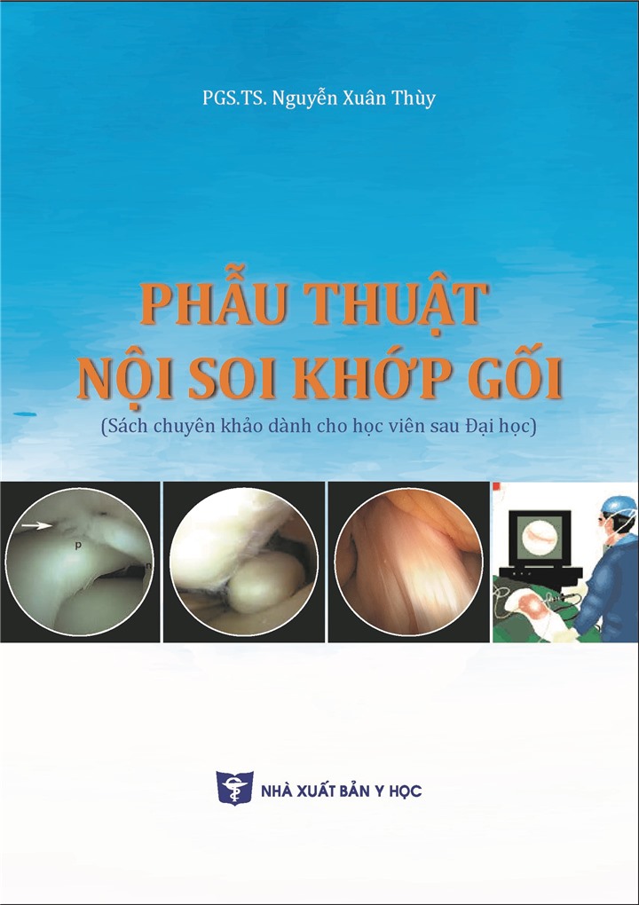 BENITO - Phẫu thuật nội soi khớp gối