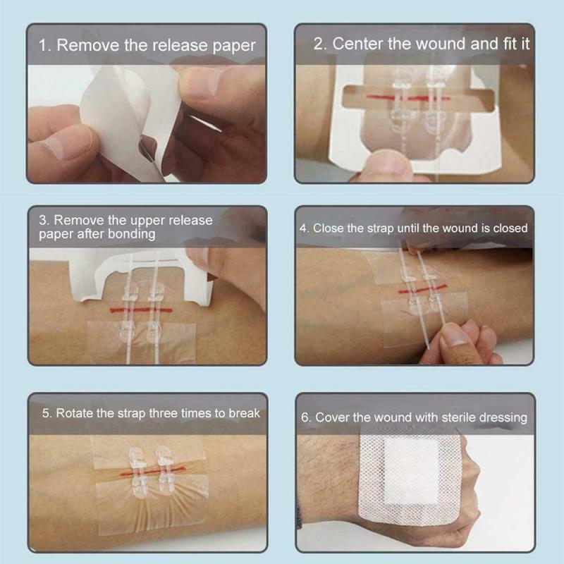 Zipper Band-aid Outdoor No-sewing Quick Wound Dressing Suture Tape Bandage Suture-free Zip Band-aids first aid Hemostasis Tool