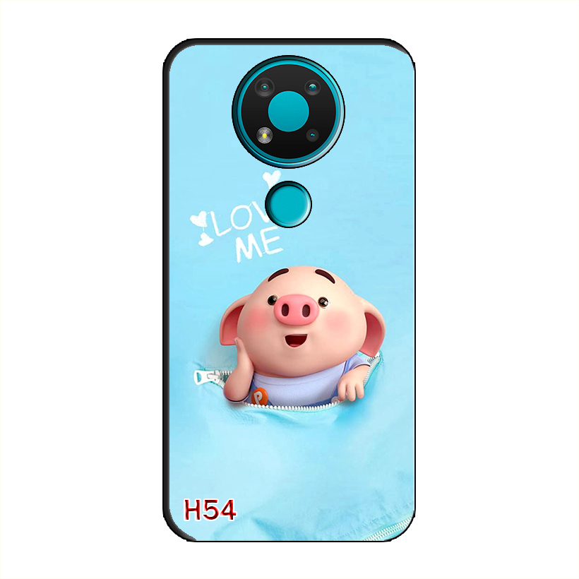 Ốp Dẻo Dành Cho NOKIA 3.4