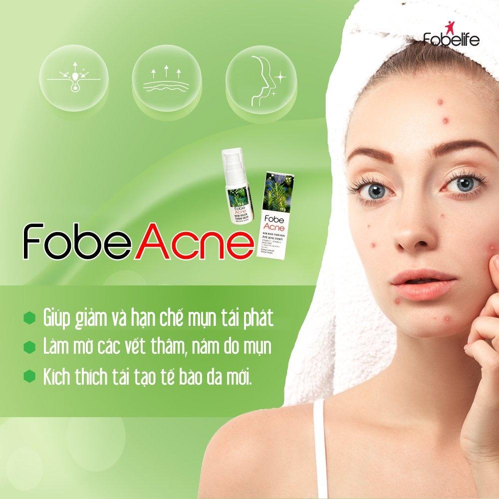 Kem Bôi Mờ Thâm Do Mụn Fobe Acne- tuýp 15g