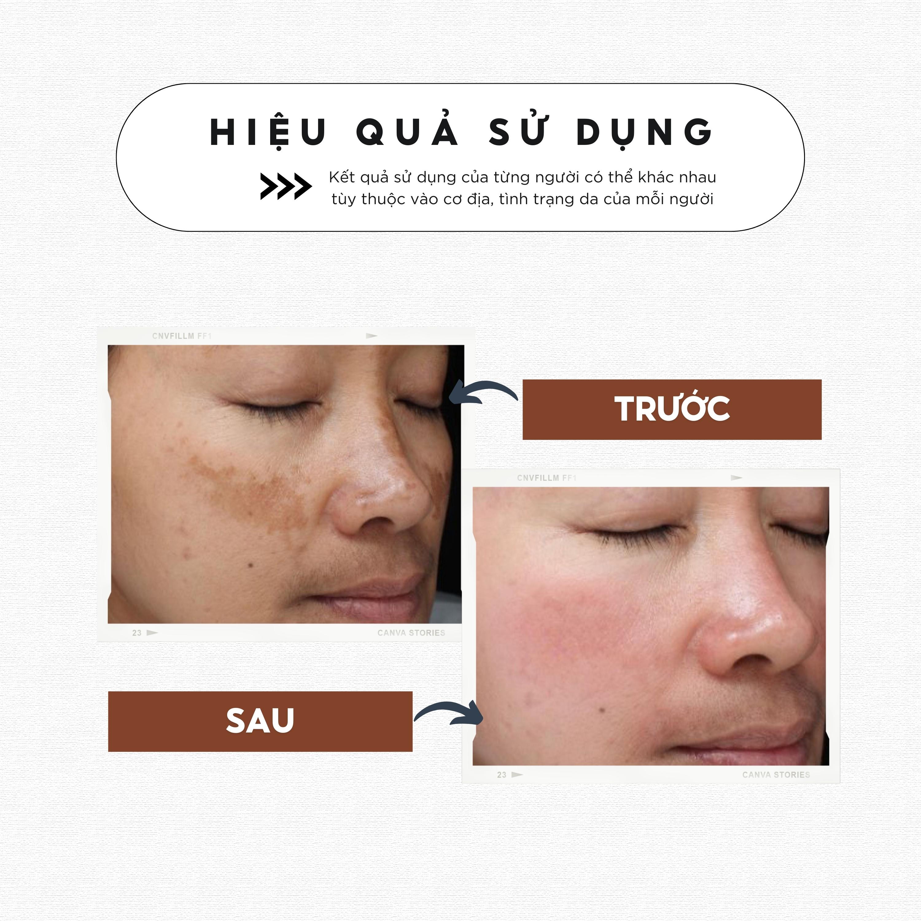 Combo Kem dưỡng và Serum dưỡng trắng và tái tạo da CHAMIS