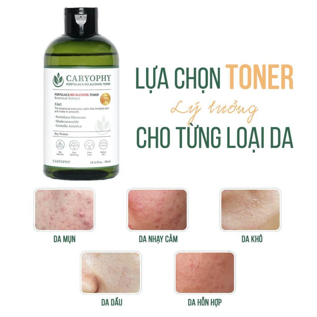 Nước hoa hồng dưỡng da giảm mụn Caryophy Portulaca Toner 300ml + Tặng Kèm 1 Băng Đô Tai Mèo Xinh Xắn ( Màu Ngẫu Nhiên)