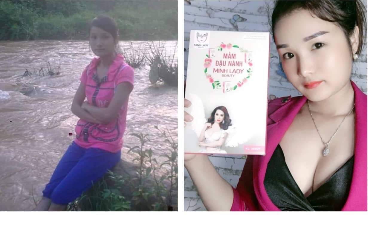 COMBO 4 Mầm Đậu Nành Tăng Vòng 1 Minh Lady Beauty tặng 1 Bịch kẹo Mầm Diệp Lục Colagen