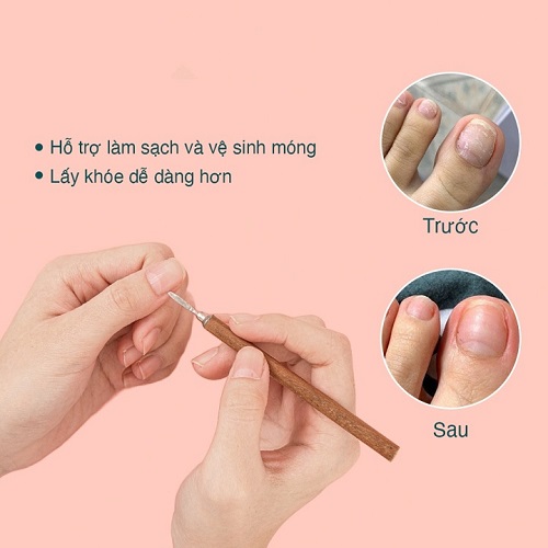 Cây lấy khóe móng tay và chân cán gỗ chuyên dụng nhỏ gọn, rất bén