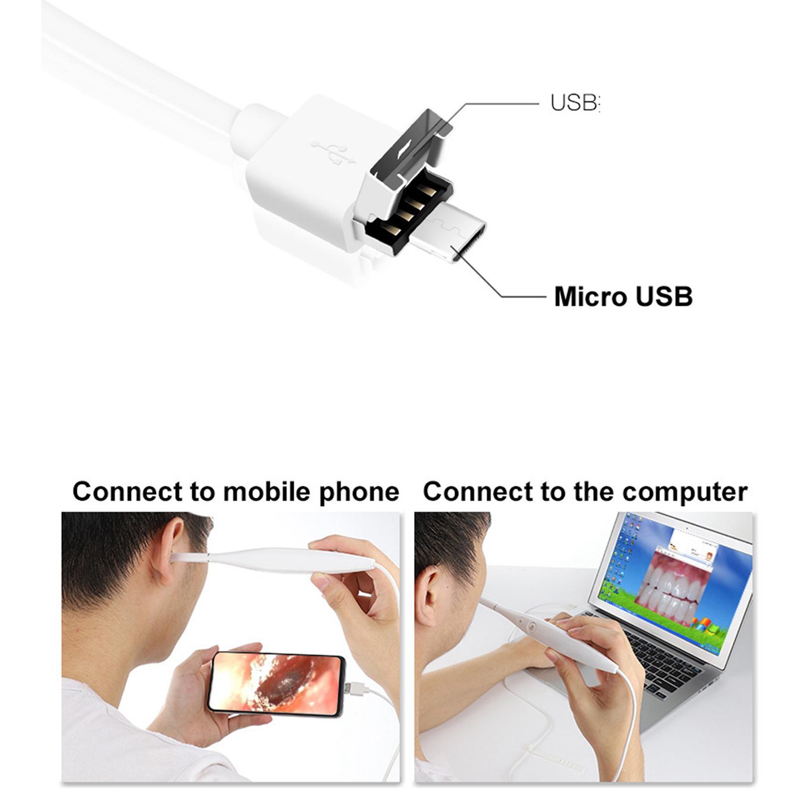 100W  Lens Intraoral  LED Lights Oral Endoscope Detachable USB