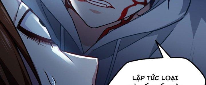 trở thành vương giả sau khi bị cắn chapter 15 53