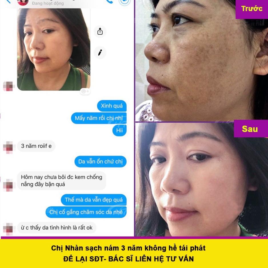 Kem nám tàn nhang, mụn, da thâm không đồng đều màu, kem gia truyền Phạm Nguyễn handmade