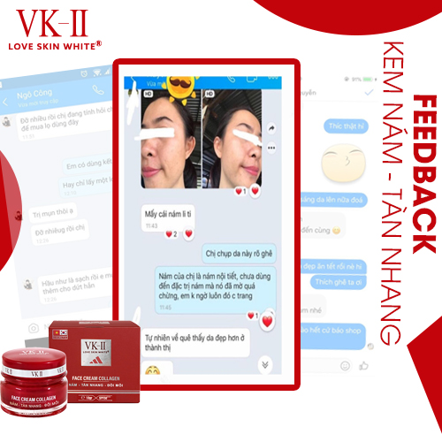 Kem Ngừa Nám - Tàn Nhang - Đồi Mồi VK II