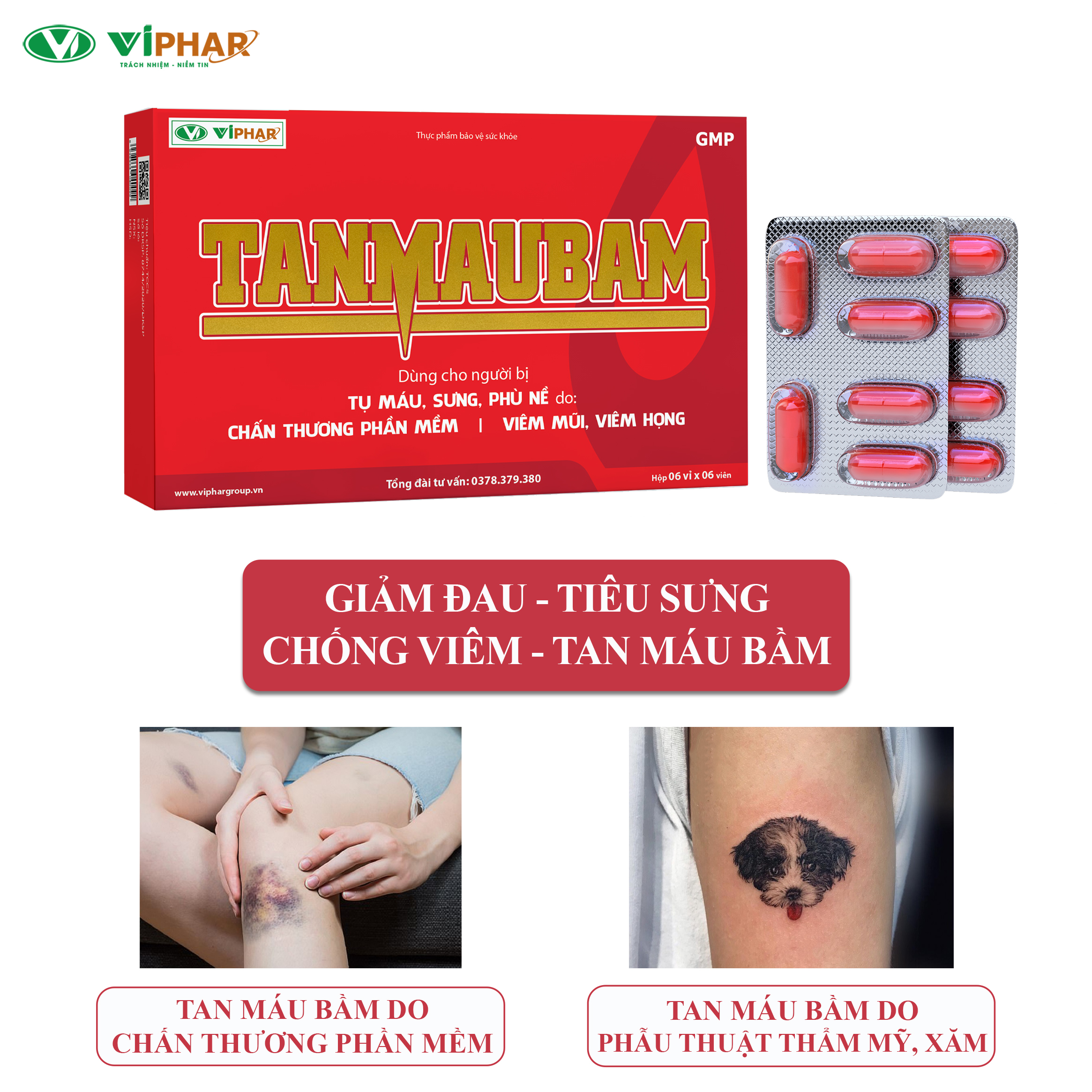 Viên Uống Giúp Tan Máu Bầm, Giảm Sưng Viêm, Giảm Đau Do Chấn Thương Phần Mềm, Phẫu Thuật, Spa TANMAUBAM VIPHAR Hộp 36 Viên