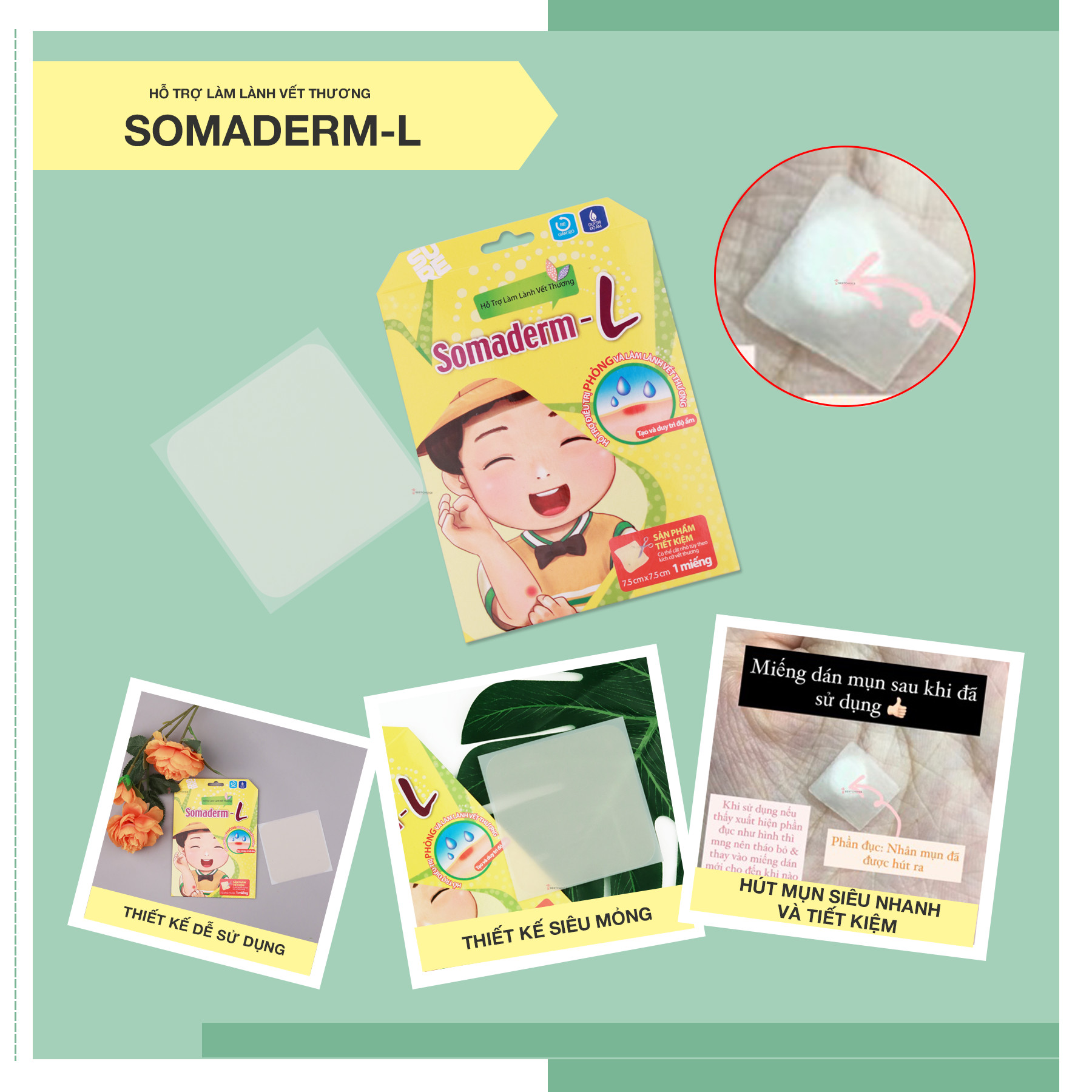 Miếng Dán Mụn - Vết Thương Somaderm-L
