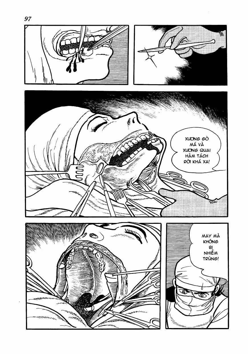 bác sĩ quái dị chapter 123 13