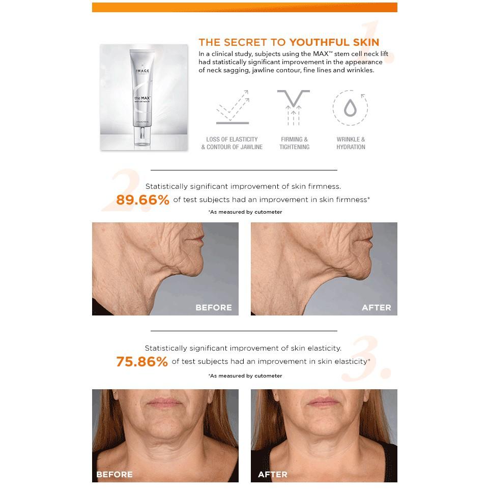 Kem săn chắc vùng cổ và ngực Image Skincare The MAX Stem Cell Neck Lift 59ml