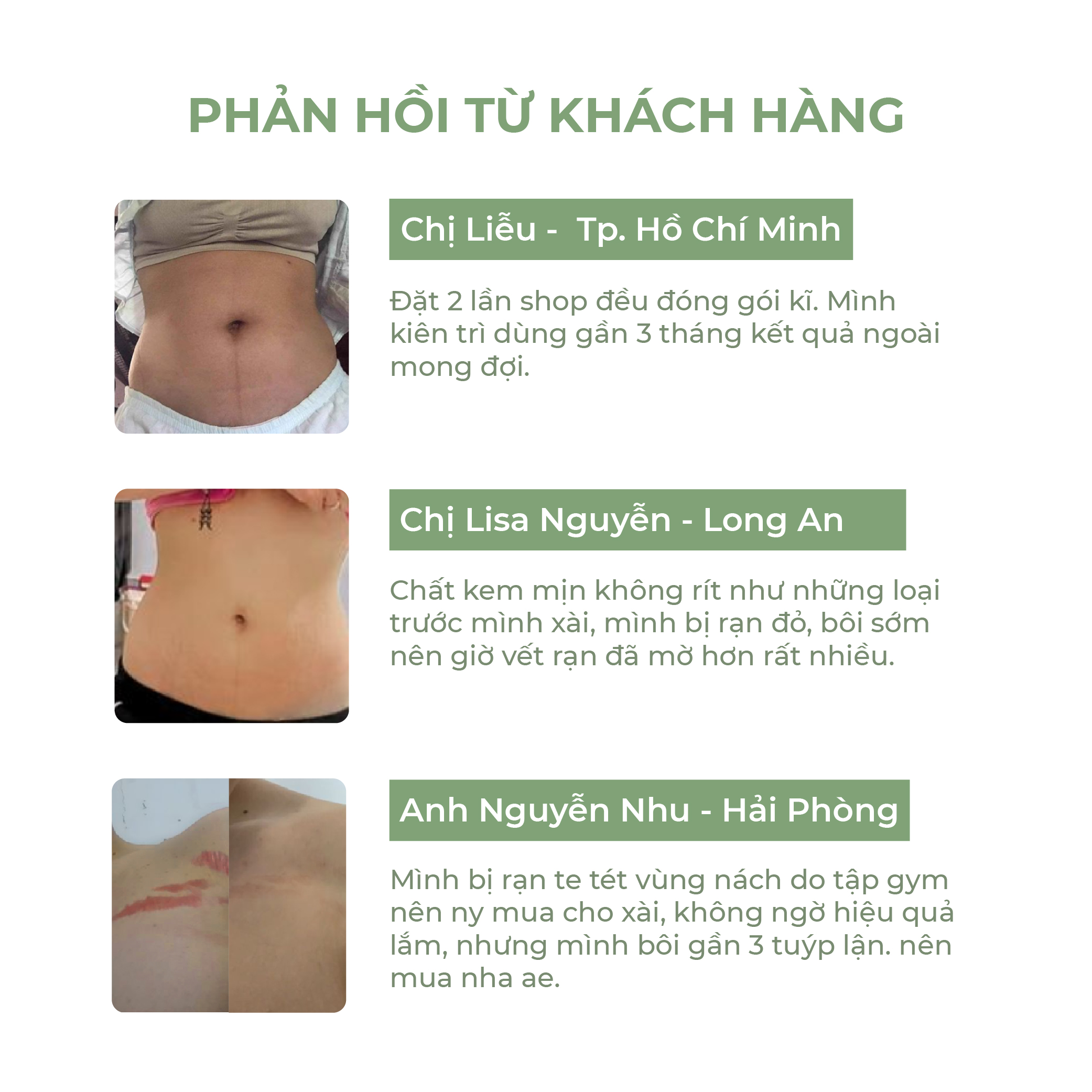 Kem Rạn Da OVELA ABERA 50ML, Dưỡng Ẩm, Giảm Rạn Cũ, Ngừa Rạn Mới, Mờ Thâm Bụng, Rạn Da Cho Mẹ Bầu