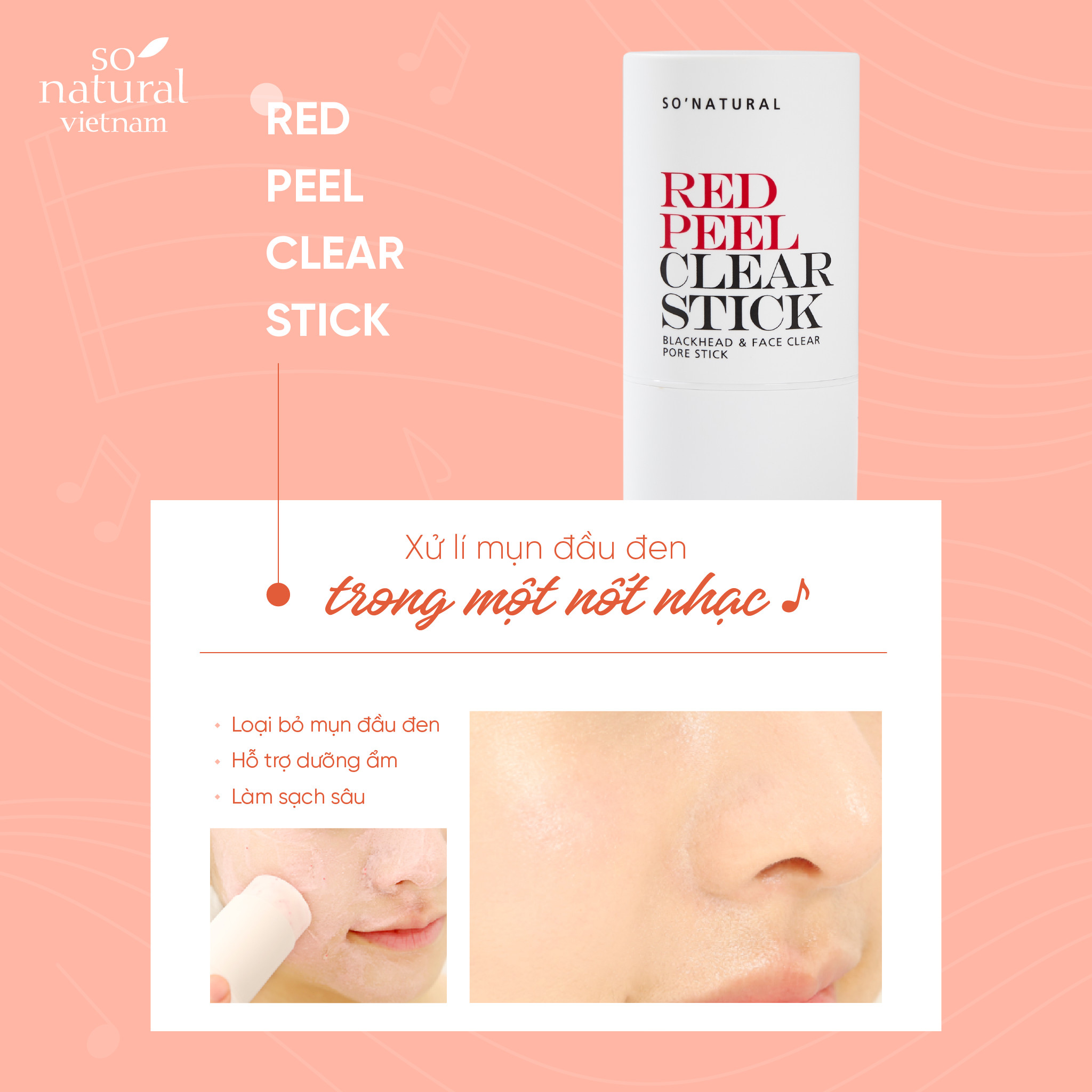 Red Peel Clear Stick Chính Hãng So Natural Pore Blackhead &amp; Face Thanh Lăn Mụn Đầu Đen 23gram