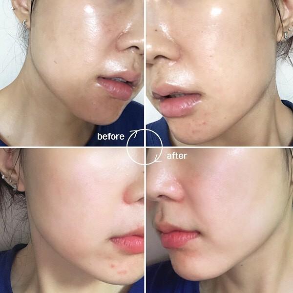 Bộ mặt nạ ampoule nâng cơ, làm sáng và chống lão hoá Dr.NDS Vlifting & Brightening mask