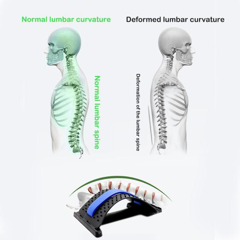 【Có hàng sẵn】Khung Nắn Chỉnh Cột Sống-Massaege Lưng Doctor Spine Đai định hình cột sống giúp chống gù lưng-dụng cụ