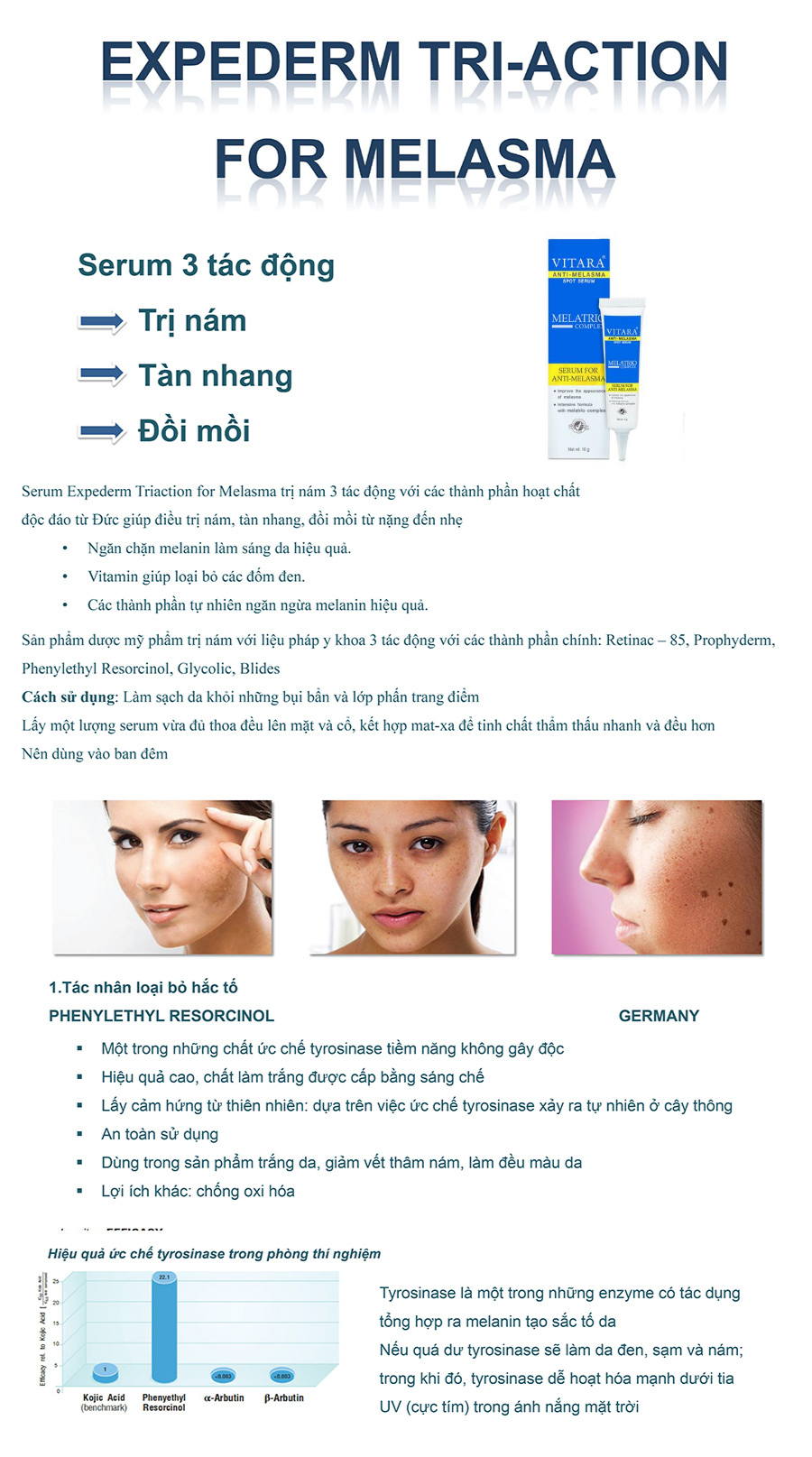 Kem làm mờ vết thâm nám VITARA ANTI MELASMA SPOT SERUM Thái Lan 10ml