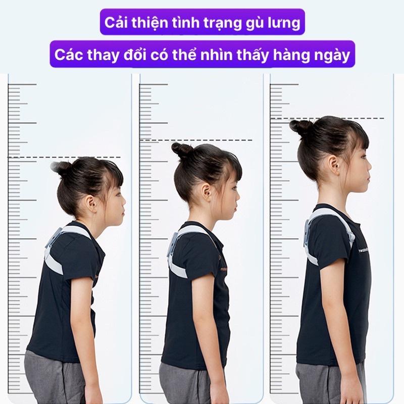 Đai Chống Gù Lưng Rung Cảm Biến Điện Tử Thông Minh cao cấp