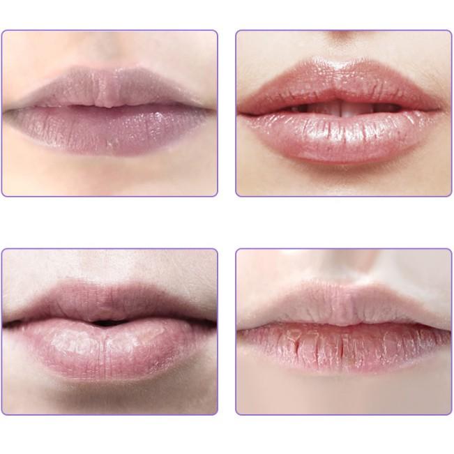 Mặt nạ dưỡng môi Sheloves Moist Lip Blam 10g