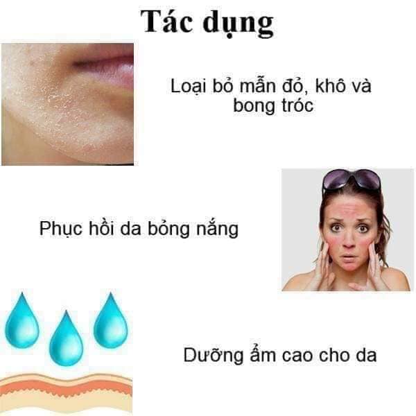 Kem Bôi Panthenol Compliment Hỗ Trợ Bôi Bỏng,Dưỡng Phục Hồi Da Bị Tổn Thương Tuýp 75ml