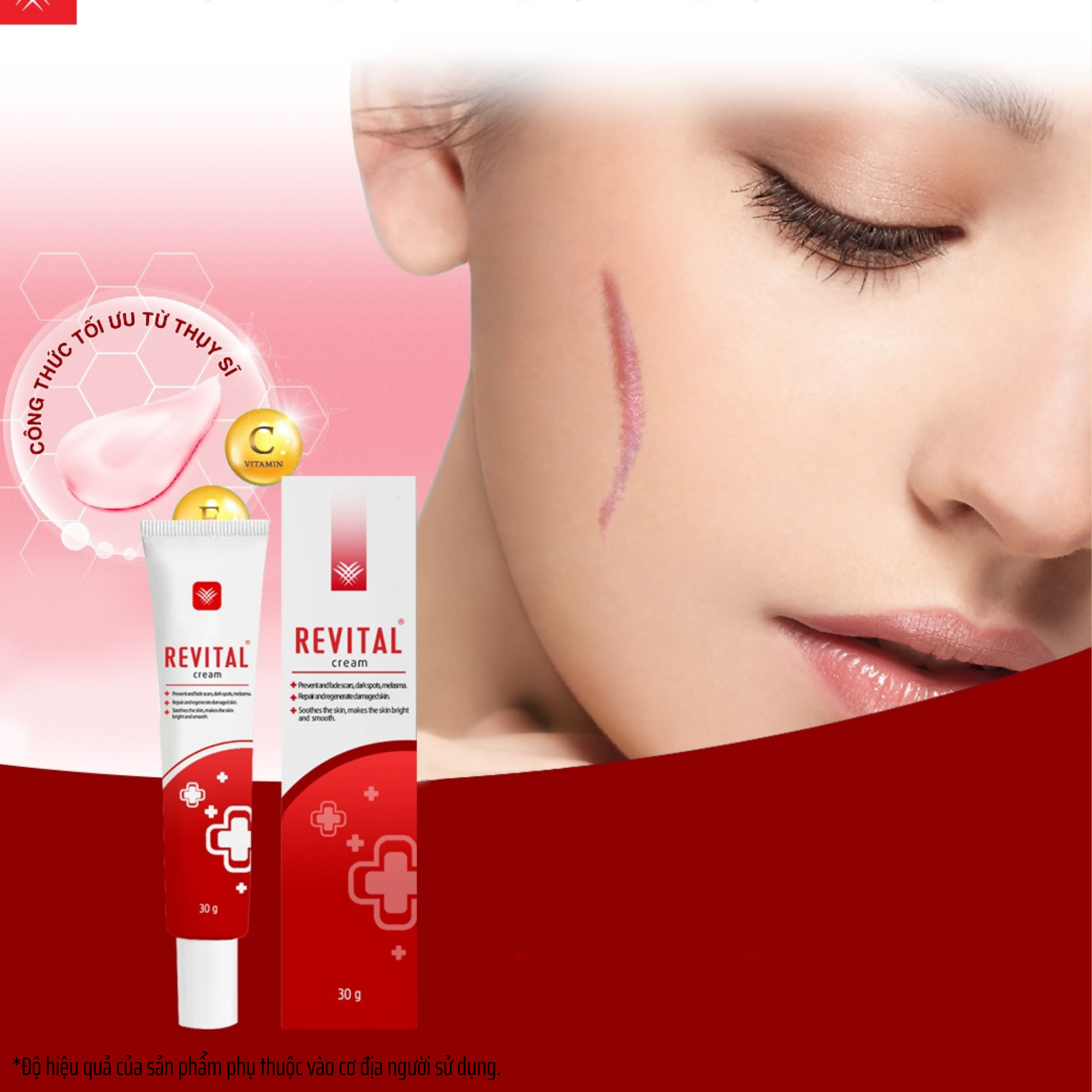 Kem Mờ Sẹo Revital 30g, Làm Trắng Da, Mờ Sẹo, Ngăn Ngừa Lão Hóa Da, Se Khít Lỗ Chân Lông