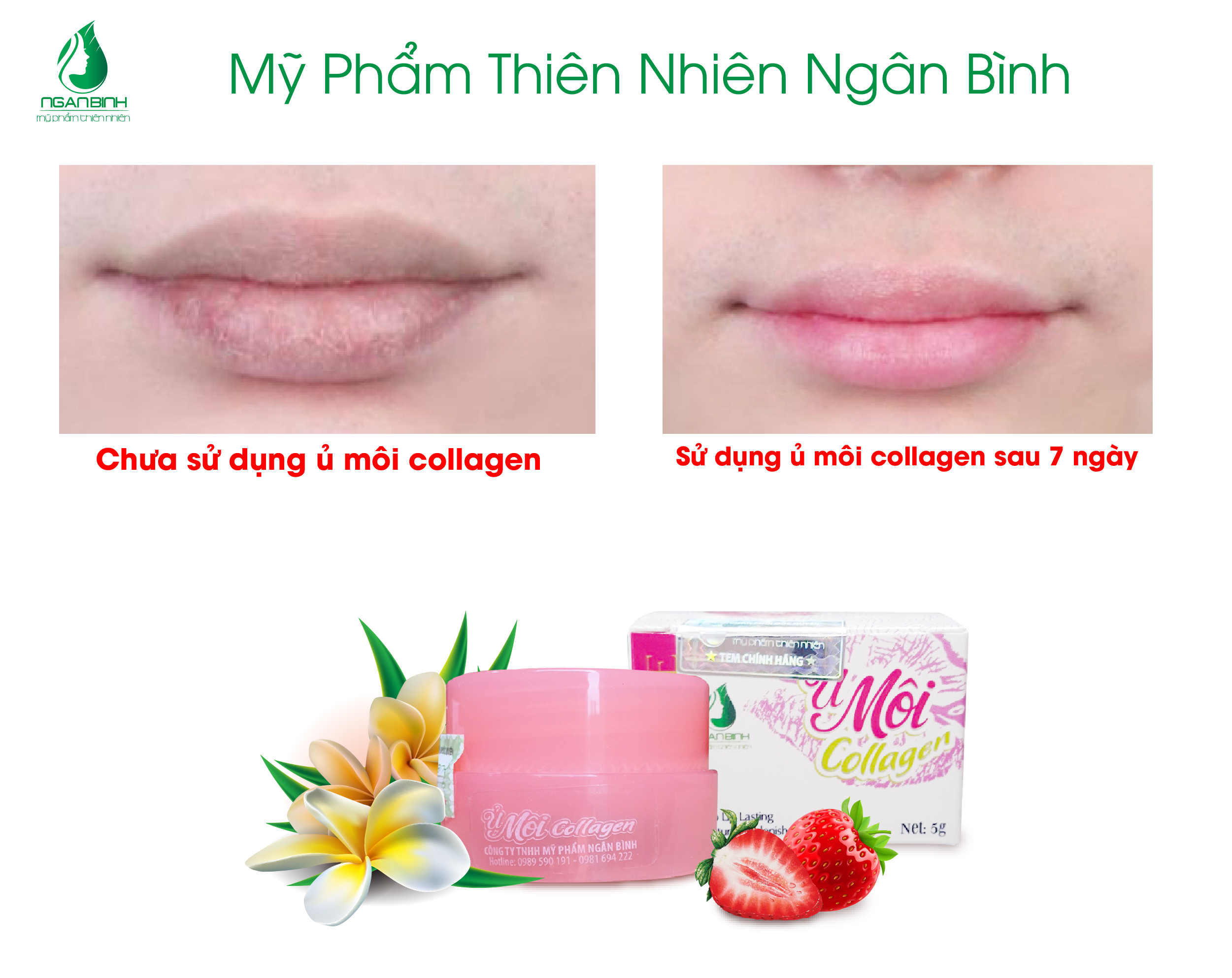 Ủ MÔI COLLAGEN