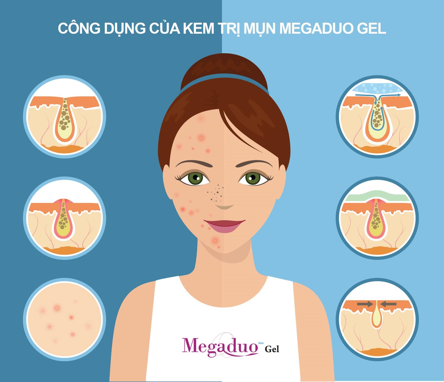 Gel Hỗ Trợ Giảm Mụn Ẩn Và Thâm Gamma Megaduo Gel 15g - Bản Plus