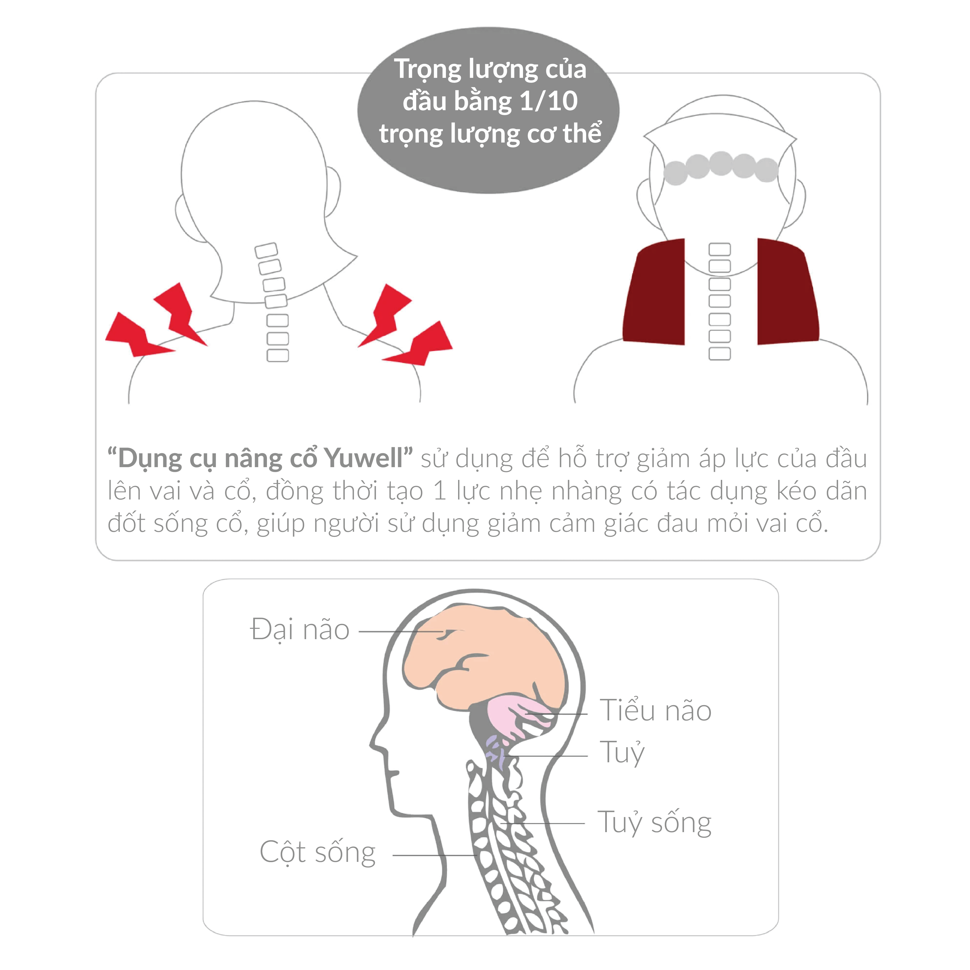 Dụng Cụ Nâng Cổ Yuwell Type B - TYPEB