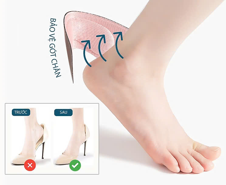 Bộ 2 cặp lót giày 4D bảo vệ gót chân và chống tuột gót giày (loại bầu) 1 CẶP KEM VÀ 1 CẶP ĐEN
