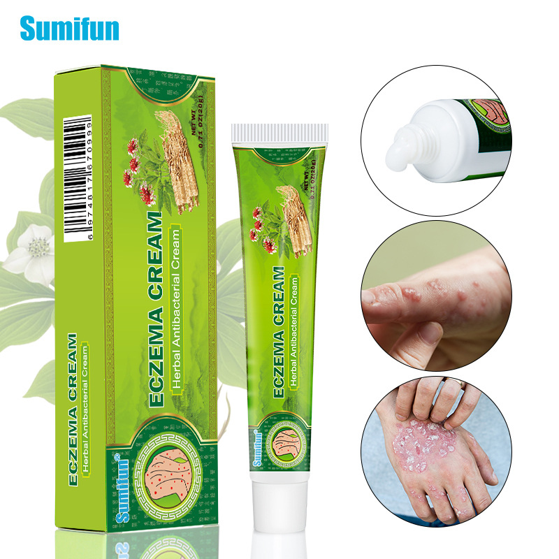 Kem hỗ trợ bôi chàm da, eczema, nấm da đầu, tổ đỉa, Mụn nước, Hắc lào, nấm đồng tiền, ... thành phần thảo dược 100%, Cam kết hết ngay.