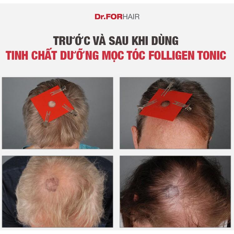 Bộ gội xả dưỡng hỗ trợ mọc tóc nuôi dưỡng da đầu khỏe mạnh Dr.FORHAIR Folligen Plus x Scalp Pack x Tonic