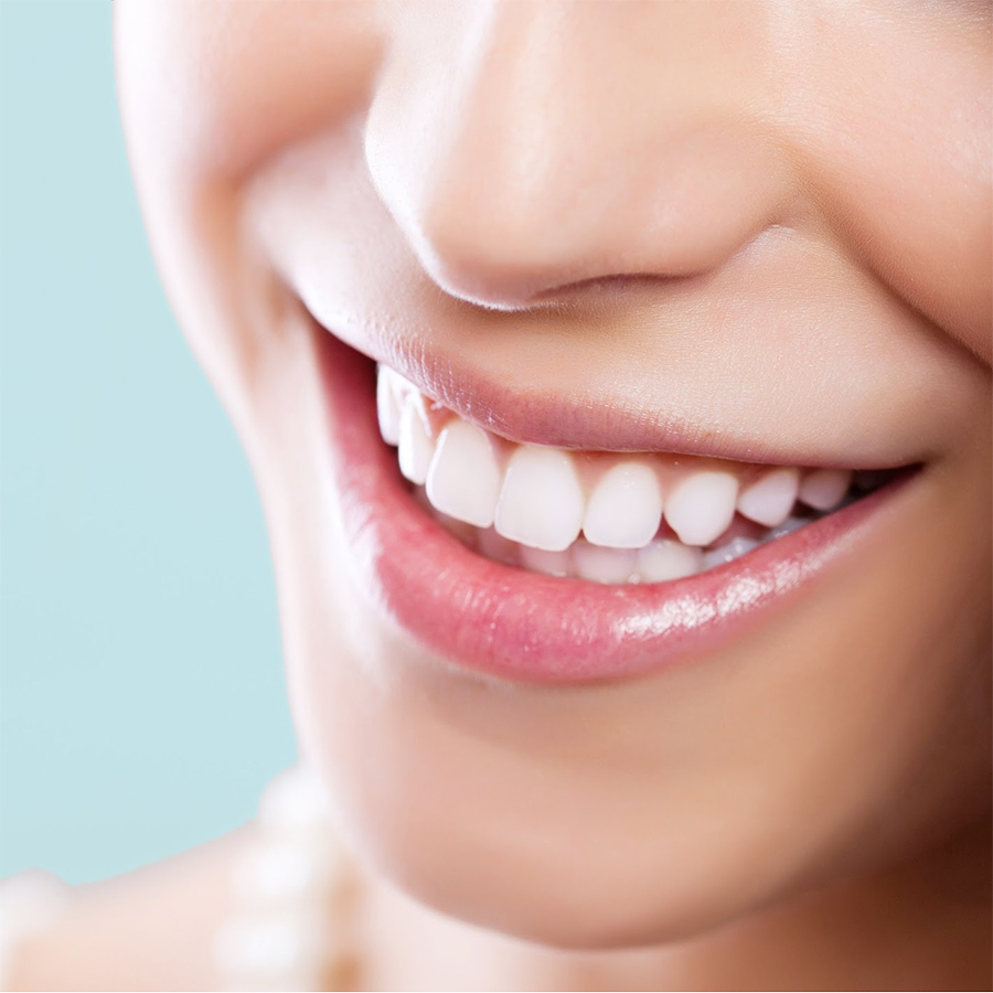 Hình ảnh Gói Dịch Vụ Tẩy Trắng Răng Tại Nha Khoa Hồng Ân