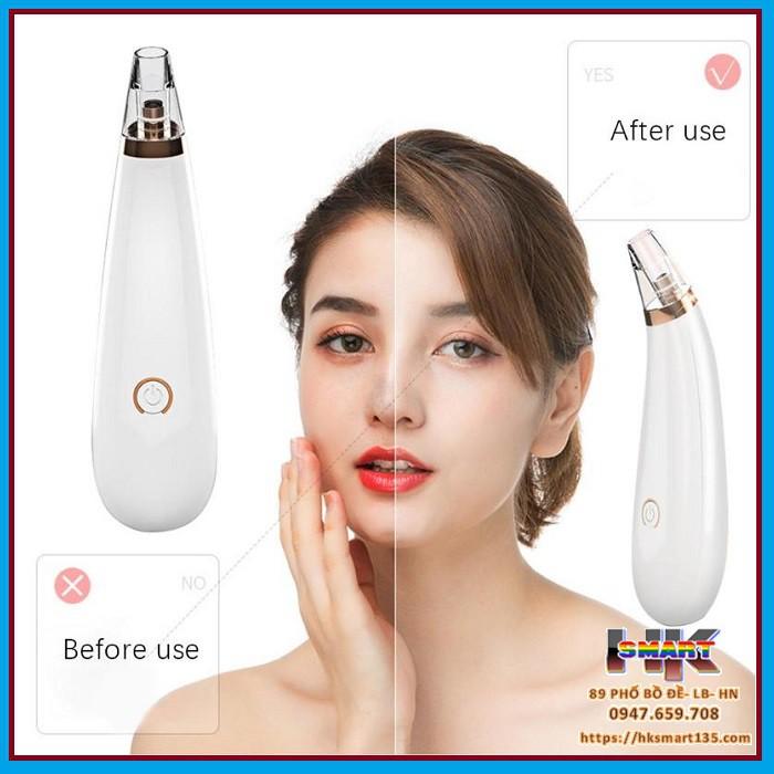 Máy hút mụn cám mụn đậu đen Black Head an toàn hiệu qủa